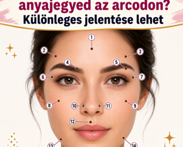 ❗👀✨ Hol található az anyajegyed az arcodon? Különleges jelentése lehet