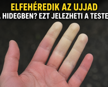„Elfehéredik az ujjad a hidegben? Ezt jelezheti a tested”