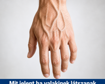 Mit jelent, ha valakinek látszanak az erei a kézfején? Itt a válasz… Mit jelent, ha valakinek látszanak az erei a kézfején? Itt a válasz…