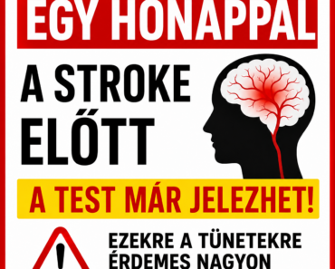🚨 Egy hónappal a stroke előtt a test már jelezhet? 🧠⚡ Ezekre a tünetekre érdemes nagyon figyelni 🚨 Egy hónappal a stroke előtt a test már jelezhet? 🧠⚡ Ezekre a tünetekre érdemes nagyon figyelni