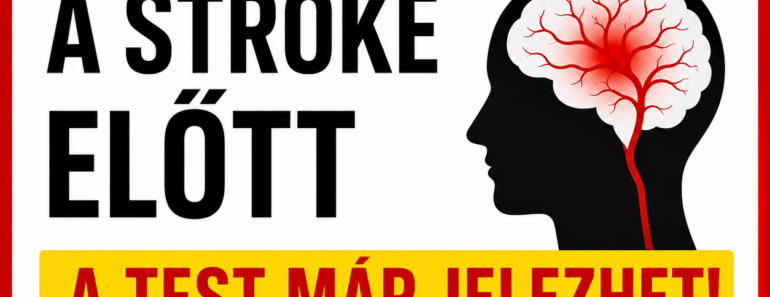 🚨 Egy hónappal a stroke előtt a test már jelezhet? 🧠⚡ Ezekre a tünetekre érdemes nagyon figyelni