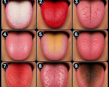 👅 9 jel, amivel a nyelved üzenhet az egészségedről 👅 9 jel, amivel a nyelved üzenhet az egészségedről