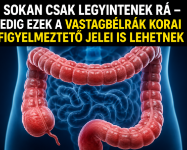 ❗ Sokan csak legyintenek rá – pedig ezek a vastagbélrák korai figyelmeztető jelei is lehetnek