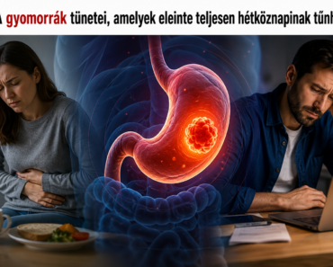 🚨 A gyomorrák tünetei, amelyek eleinte teljesen hétköznapinak tűnhetnek
