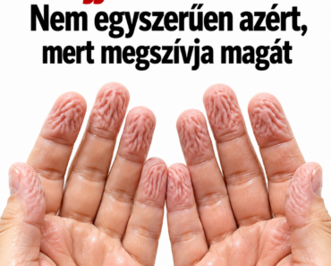 Miért lesz ráncos az ujjad a vízben? – Nem egyszerűen azért, mert megszívja magát Miért lesz ráncos az ujjad a vízben? – Nem egyszerűen azért, mert megszívja magát